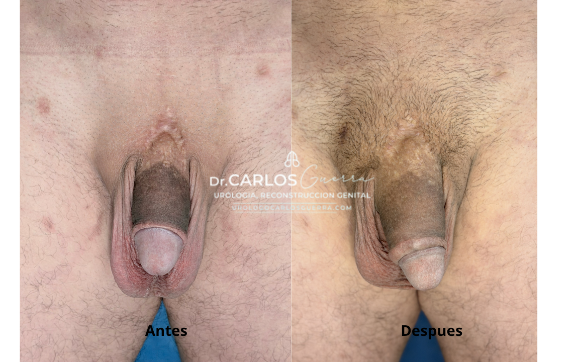 Asimismo, la transformación del paciente