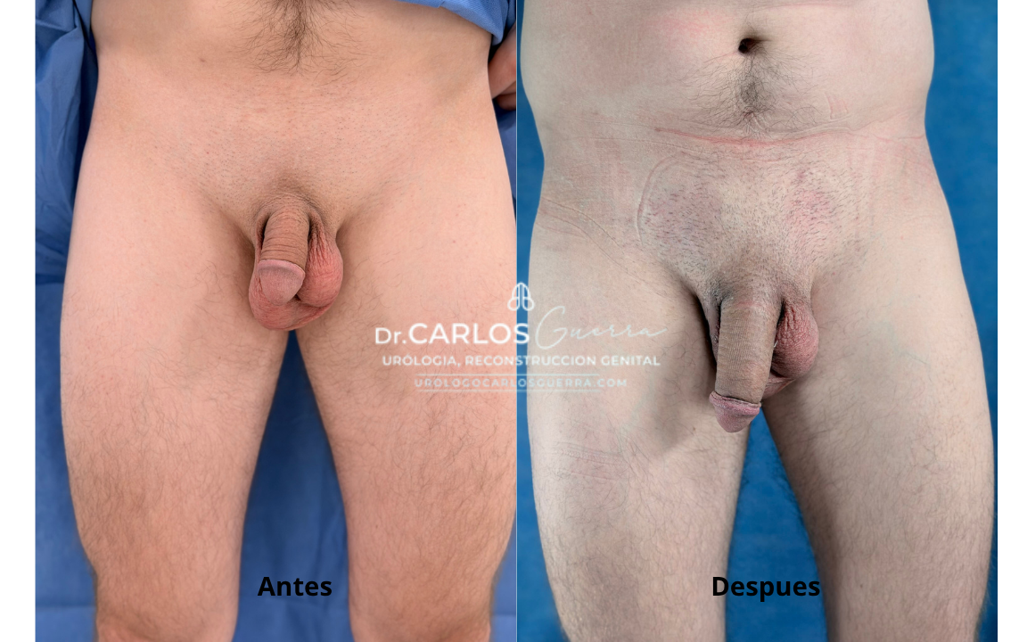 Por otro lado, se aprecia el resultado estético